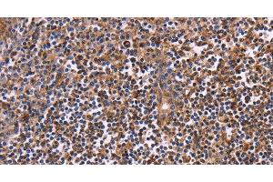 Immunohistochemistry of paraffin-embedded Human tonsil using CLUAP1 Polyclonal Antibody at dilution of 1:50 (CLUAP1 anticorps)