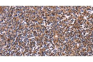 Immunohistochemistry of paraffin-embedded Human tonsil using CLUAP1 Polyclonal Antibody at dilution of 1:50