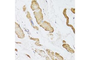 Immunohistochemistry of paraffin-embedded human esophagus using CKMT2 antibody. (CKMT2 anticorps  (AA 40-230))