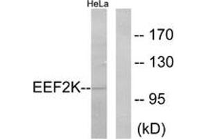 Western blot analysis of extracts from HeLa cells, treated with serum 10% 15', using eEF2K (Ab-366) Antibody. (EEF2K anticorps  (AA 331-380))