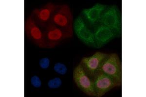 WDR70 Mouse Monoclonal Antibody staining Hela cells by IF/ICC. (WDR70 anticorps)
