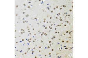 Immunohistochemistry of paraffin-embedded mouse brain using BTK antibody (ABIN5970757) at dilution of 1/100 (40x lens). (BTK anticorps)