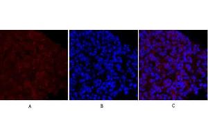 Immunofluorescence analysis of mouse lung tissue. (MEK1/2 anticorps)