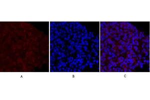 Immunofluorescence analysis of mouse lung tissue.