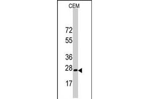 Western blot analysis of BARX1 polyclonal antibody  in CEM cell line lysates (35 ug/lane). (BARX1 anticorps  (C-Term))