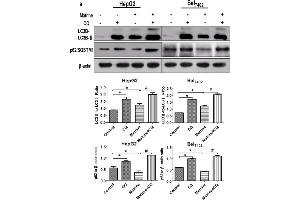CQ inhibited matrine-induced autophagic flux in HepG2 and Bel7402 cells.