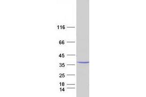 Validation with Western Blot