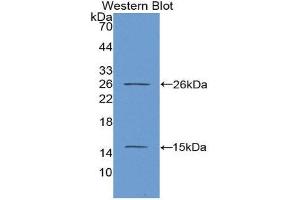 Western Blotting (WB) image for anti-Antigen Identified By Monoclonal Antibody Ki-67 (MKI67) (AA 2815-2928) antibody (Biotin) (ABIN1175455) (Ki-67 anticorps  (AA 2815-2928) (Biotin))