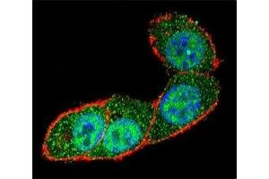 Confocal immunofluorescent analysis of SMAD3 antibody with HeLa cells followed by Alexa Fluor 488-conjugated goat anti-rabbit lgG (green).