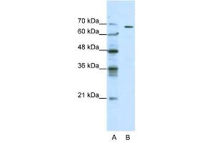 GABRQ antibody used at 0. (GABRQ anticorps)