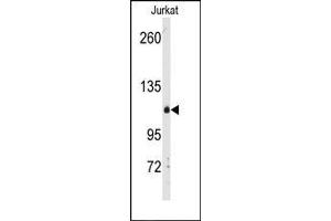 Image no. 1 for anti-Diacylglycerol Kinase, delta 130kDa (DGKD) (C-Term) antibody (ABIN360608)