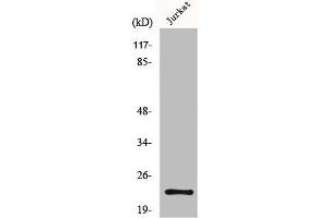 Western Blot analysis of Jurkat cells using MGMT Polyclonal Antibody