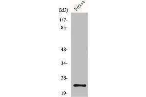 Western Blot analysis of Jurkat cells using MGMT Polyclonal Antibody (MGMT anticorps  (N-Term))