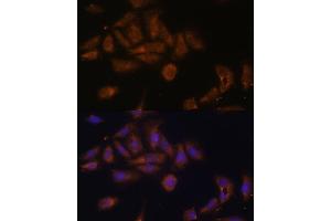 Immunofluorescence analysis of U-2 OS cells using RPL7A antibody (ABIN6128658, ABIN6147151, ABIN6147153 and ABIN6218286) at dilution of 1:100.