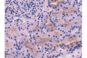 Detection of ACE in Human Kidney Tissue using Polyclonal Antibody to Angiotensin I Converting Enzyme (ACE)