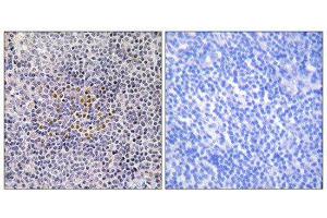 Immunohistochemistry (IHC) image for anti-X-Ray Repair Complementing Defective Repair in Chinese Hamster Cells 3 (XRCC3) (Internal Region) antibody (ABIN1850510)
