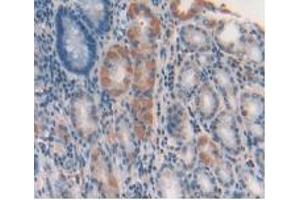 IHC-P analysis of Human Stomach Tissue, with DAB staining. (GDF5 anticorps  (AA 86-501))