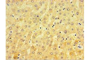 Immunohistochemistry of paraffin-embedded human liver tissue using ABIN7148440 at dilution of 1:100