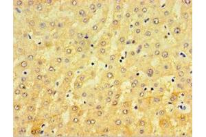 Immunohistochemistry of paraffin-embedded human liver tissue using ABIN7148440 at dilution of 1:100 (CRX anticorps  (AA 120-285))