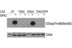 Western blot of CK2α(Phospho- Thr360/Ser362) antibody and CK2α antibody in vitro kinase assay. (CSNK2A1/CK II alpha anticorps  (pSer362, pThr360))