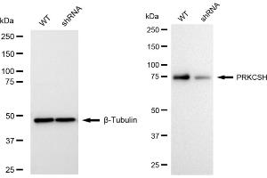 Western blotting analysis using PRKCSH antibody (ABIN7799984). (Recombinant PRKCSH anticorps)