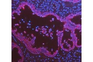 IF analysis of Cytokeratin 8/KRT8 using anti-Cytokeratin 8/KRT8 antibody (ABIN5518853).