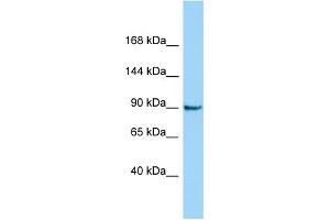 Host: Rabbit Target Name: CRNKL1 Sample Type: Jurkat Whole Cell lysates Antibody Dilution: 1. (CRNKL1 anticorps  (C-Term))