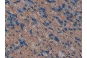 Detection of MRP1 in Mouse Stomach Tissue using Polyclonal Antibody to Multidrug Resistance Associated Protein 1 (MRP1)