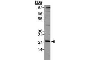 Western blot analysis of PSMD10 in HeLa lysate using with PSMD10 polyclonal antibody . (PSMD10 anticorps  (AA 100-200))