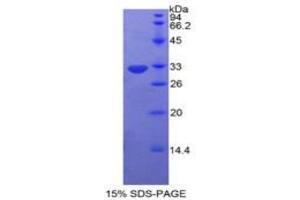 SDS-PAGE analysis of Human Protein Kinase C Eta Protein. (PKC eta Protéine)