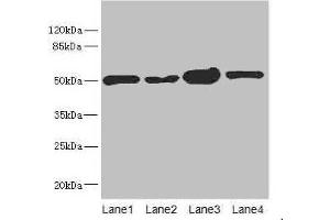 Western blot All lanes: CHN1 antibody at 6. (CHN1 anticorps  (AA 1-200))