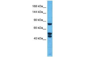 Host:  Rabbit  Target Name:  KDM3B  Sample Type:  Thymus Tumor lysates  Antibody Dilution:  1. (KDM3B anticorps  (N-Term))