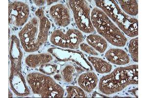 Image no. 3 for anti-Melan A (MLANA) antibody (ABIN1499425) (MLANA anticorps)