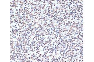 Immunohistochemistry of paraffin-embedded Human tonsil using Phospho-PRKAA1(T183)/PRKAA2(T172) Polyclonal Antibody at dilution of 1:100 (40x lens).