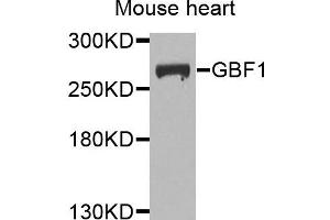 Western blot analysis of extracts of mouse heart cells, using GBF1 antibody.