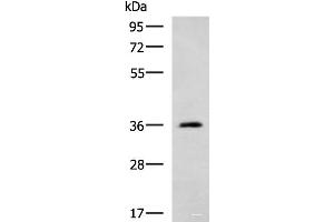 Western blot analysis of Human cerebella tissue lysate using ATP1B2 Polyclonal Antibody at dilution of 1:650 (ATP1B2 anticorps)