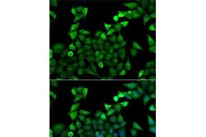 Immunofluorescence analysis of A-549 cells using TPSAB1 Polyclonal Antibody (TPSAB1 anticorps)