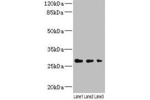 Western blot All lanes: LRRC57 antibody at 4 μg/mL Lane 1: Mouse liver tissue Lane 2: Mouse kidney tissue Lane 3: Mouse lung tissue Secondary Goat polyclonal to rabbit IgG at 1/10000 dilution Predicted band size: 27 kDa Observed band size: 27 kDa (LRRC57 anticorps  (AA 1-239))