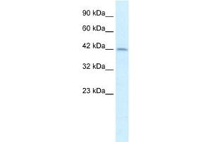 WB Suggested Anti-PAX3 Antibody Titration:  2. (Paired Box 3 anticorps  (Middle Region))