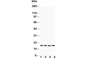Western blot testing of Caveolin-2 antibody and Lane 1:  HeLa (Caveolin 2 anticorps  (AA 1-162))