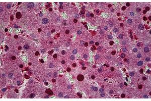 Human Liver: Formalin-Fixed, Paraffin-Embedded (FFPE) (FZR1 anticorps  (AA 1-494))
