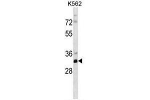 PRPS2 Antibody (Center) western blot analysis in K562 cell line lysates (35µg/lane). (PRPS2 anticorps  (Middle Region))