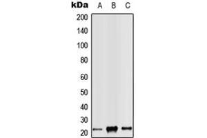 Western blot analysis of RAB14 expression in Jurkat (A), Raw264. (RAB14 anticorps  (C-Term))