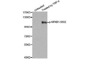 Western blot analysis of extracts from 293 cells untreated or treated with TNF-a using Phospho-NFKB1-S932 antibody (ABIN2988211). (NFKB1 anticorps  (pSer932))