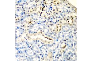 Immunohistochemistry of paraffin-embedded mouse kidney using DCTD antibody at dilution of 1:200 (40x lens). (DDX1 anticorps)