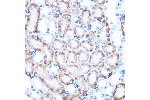 Immunohistochemistry of paraffin-embedded mouse kidney using [KO Validated] CD168/RHAMM Rabbit mAb  at dilution of 1:100 (40x lens).