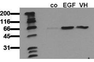 Western Blotting (WB) image for anti-V-Akt Murine Thymoma Viral Oncogene Homolog 1 (AKT1) (pSer473) antibody (ABIN126853) (AKT1 anticorps  (pSer473))