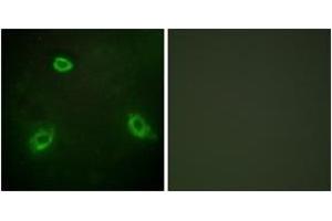 Immunofluorescence analysis of HepG2 cells, using TM16G Antibody. (Anoctamin 7 anticorps  (AA 881-930))