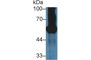 Western Blot; Sample: Mouse Pancreas lysate; Primary Ab: 3µg/ml Rabbit Anti-Mouse GP2 Antibody Second Ab: 0. (GP2 anticorps  (AA 301-506))