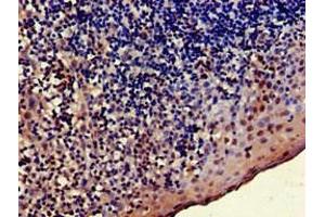 Immunohistochemistry of paraffin-embedded human tonsil tissue using ABIN7173904 at dilution of 1:100 (TRADD anticorps  (AA 1-312))